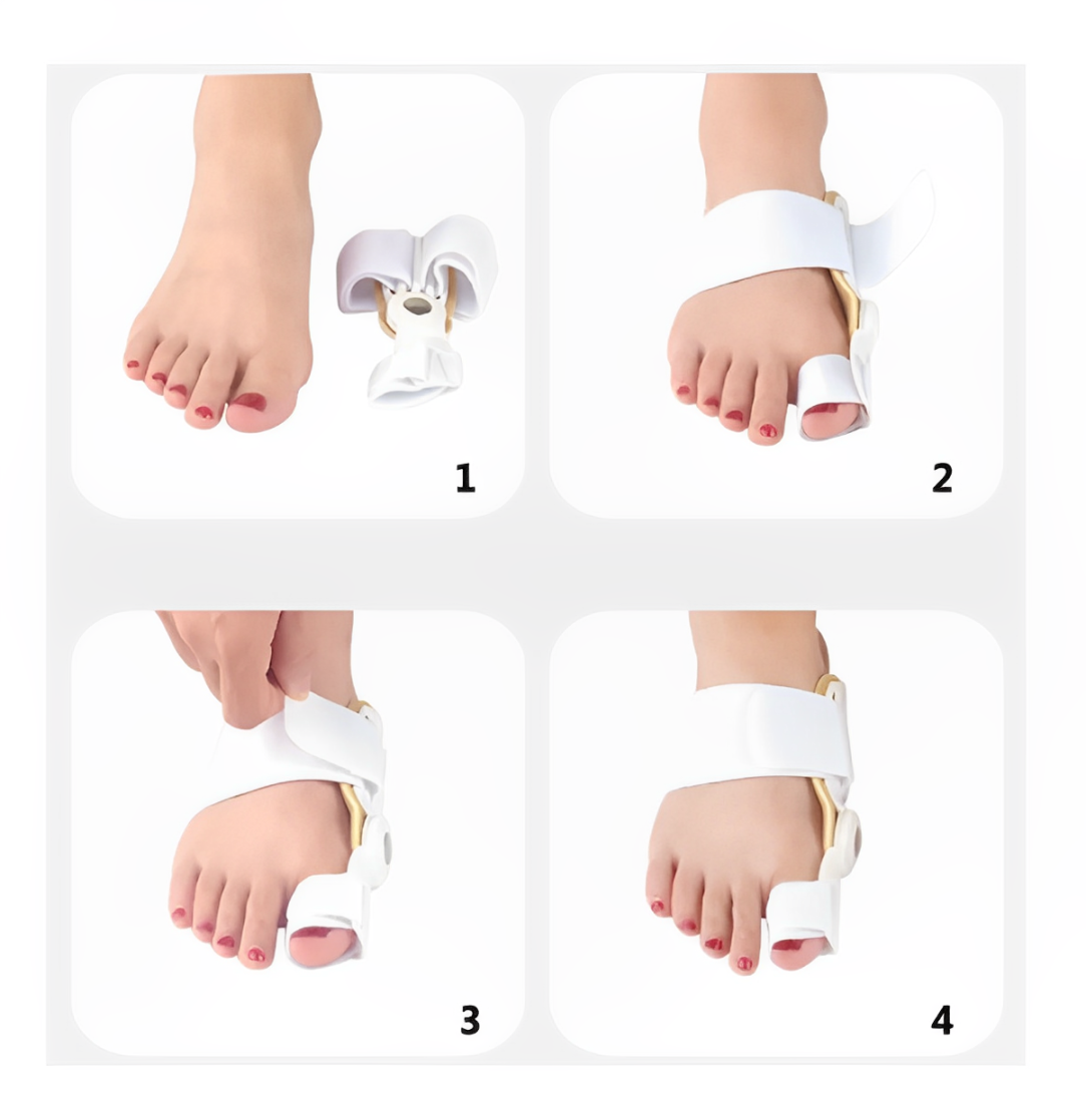 Bunex™ - Corrector de juanetes